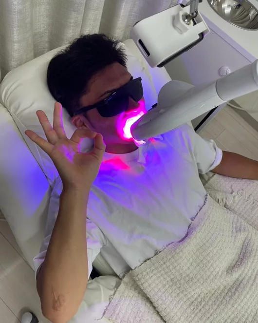 Most Popular Self-Whitening with 30-Minute Irradiation and Local English Map 90 Minutes